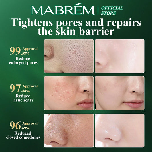 MABREM Pomegranate Fine Pores Face Serum Whitening Plant Skin Care Anti Aging Anti Wrinkle Cream Reduce Acne Marks Care 10ml