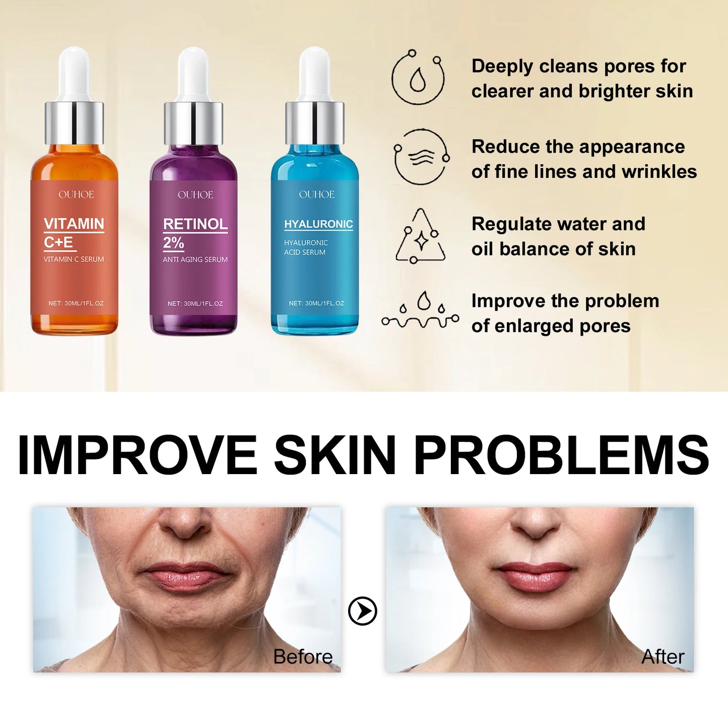 OUHOE Facial essence Deeply moisturizes, reduces fine lines, tightens skin, brightens complexion, and facial care essence