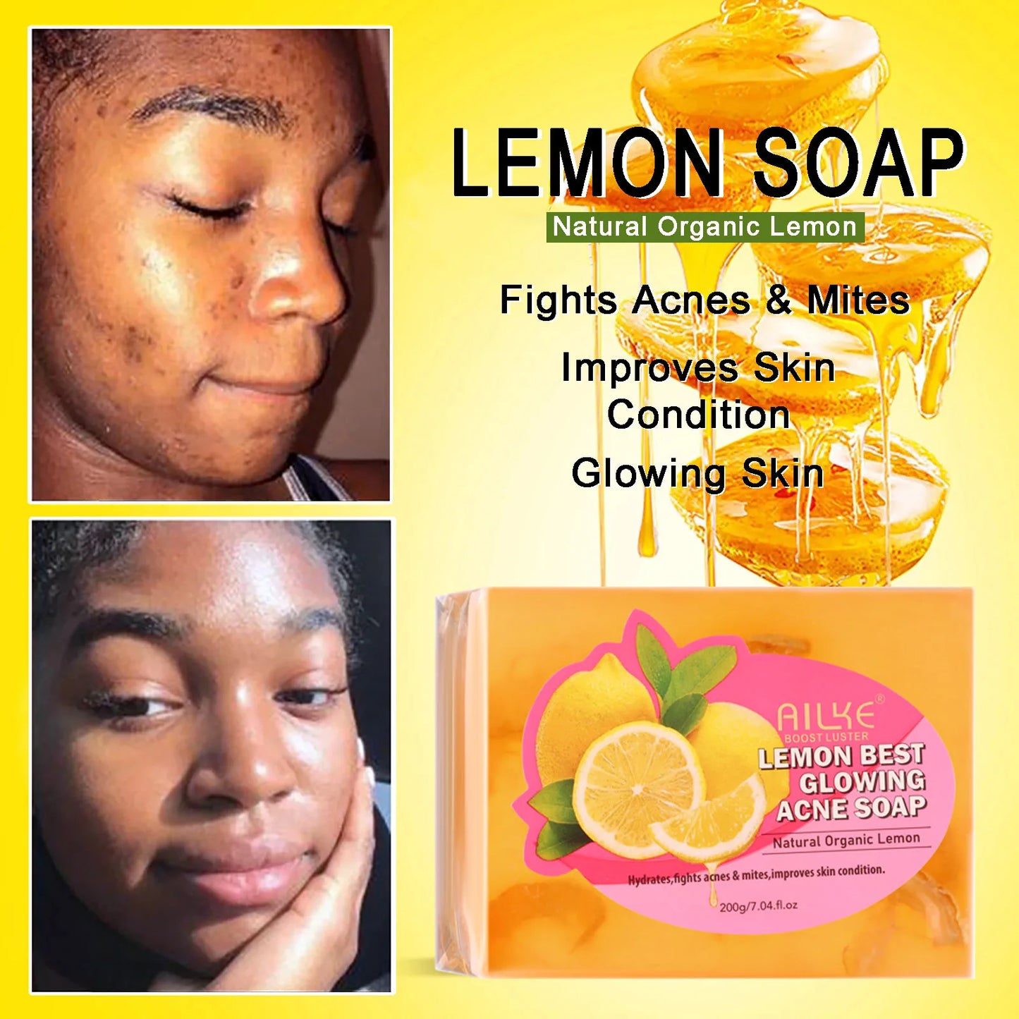 AILKE Spots Remover Soap Bars, Deep Cleansing, Moisturizing, Skin Glow, with Natural Lemon, Olive Oil, Cruelty Free Body Wash