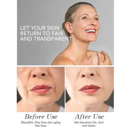 AILKE Face Cream With Hyaluron Scars Whitening Moisturizing Lifting Anti-aging Women Sleeping Dry Korean Bleaching Skin Care