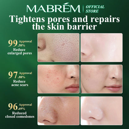 MABREM Pomegranate Fine Pores Face Serum Whitening Plant Skin Care Anti Aging Anti Wrinkle Cream Reduce Acne Marks Care 10ml