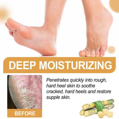 30ml Foot Callus Remover Spray Quickly Soften Calluses Exfoliation Dry Feet Skin Hydrating Foot Dead Skin Spray Foot Care