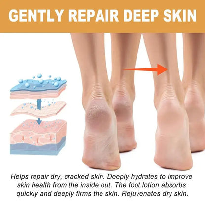 30ml Foot Callus Remover Spray Quickly Soften Calluses Exfoliation Dry Feet Skin Hydrating Foot Dead Skin Spray Foot Care