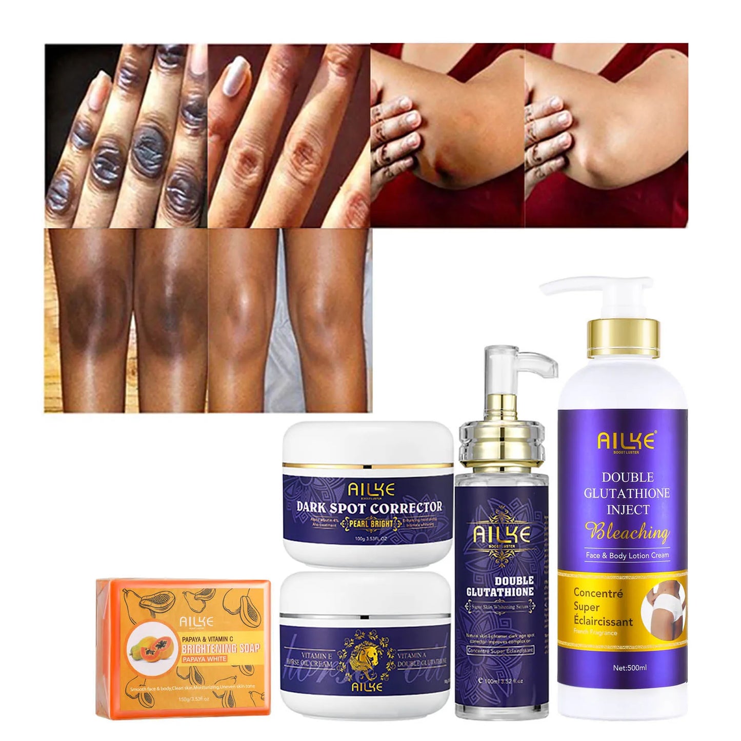 AILKE Glutathione 5-in-1 Women Skin Care Kit, With Body Lotion,  Serum, Stains Removal Cream, Body Cream, Brightening Soap