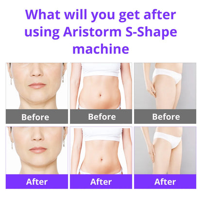 Aristorm S Shape Machine 30K Ultrasound Body Shape Facial Lifting home appliance body shaping massage equipment
