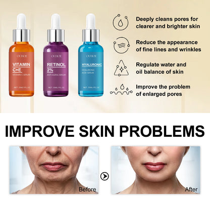 OUHOE Facial essence Deeply moisturizes, reduces fine lines, tightens skin, brightens complexion, and facial care essence