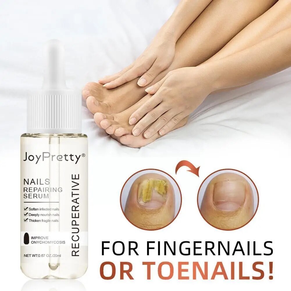 7 DAYS Repair Nail Fungus Treatments Essence Foot Care Fungal Nails Toe Removal Anti-Infection Onychomycosis Serum Gel Q0P8