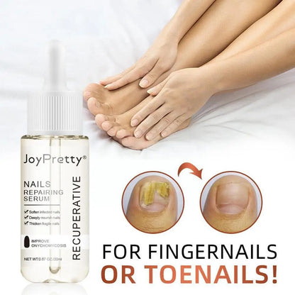 7 DAYS Repair Nail Fungus Treatments Essence Foot Care Fungal Nails Toe Removal Anti-Infection Onychomycosis Serum Gel Q0P8