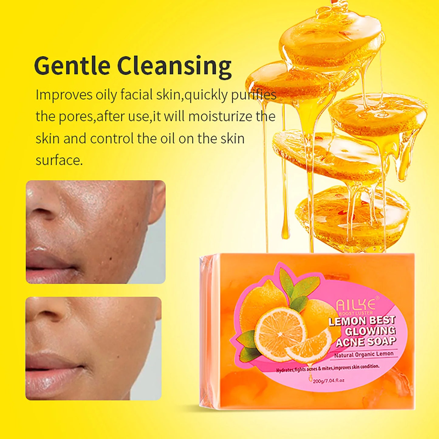 AILKE Spots Remover Soap Bars, Deep Cleansing, Moisturizing, Skin Glow, with Natural Lemon, Olive Oil, Cruelty Free Body Wash