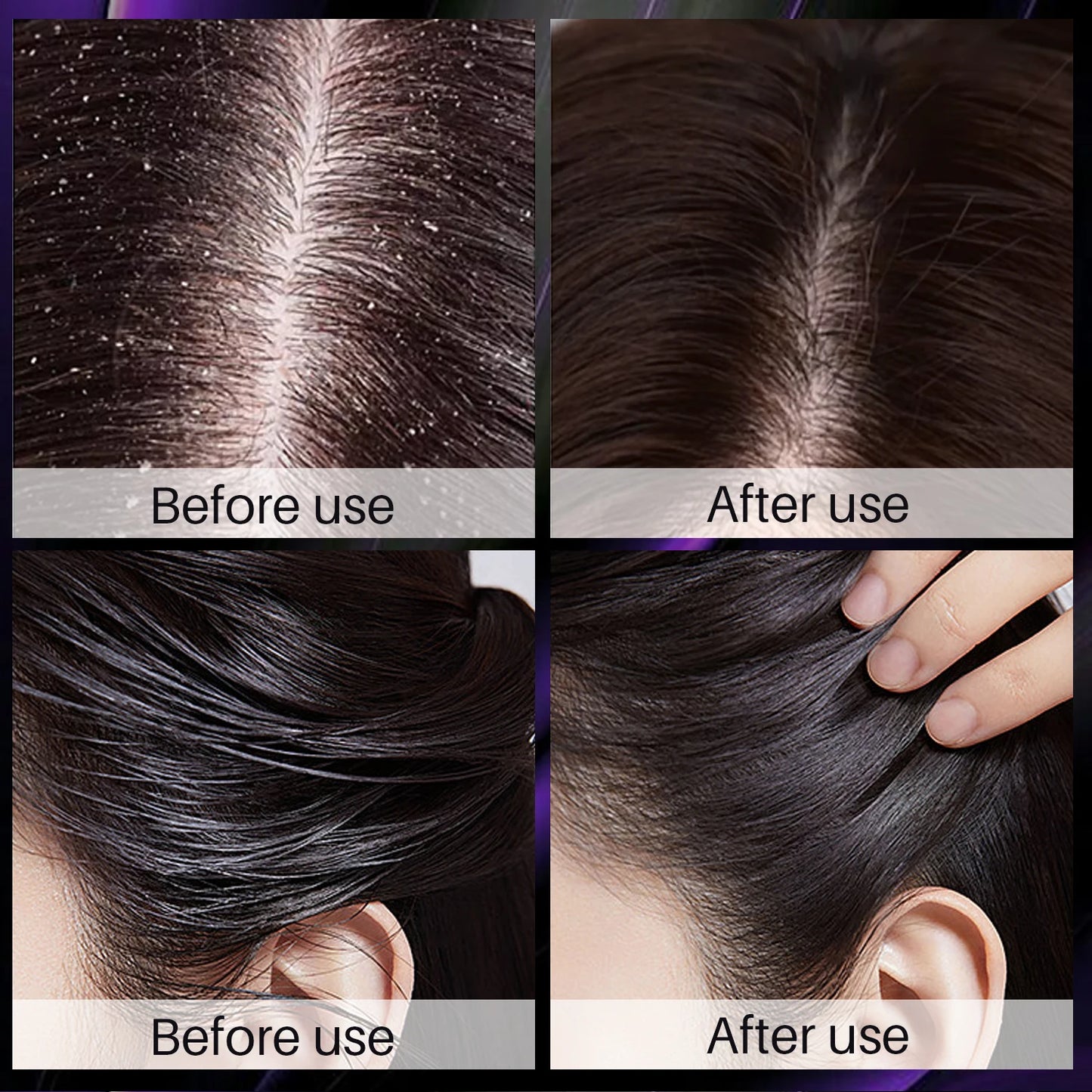 Hair Shampoo For Fast Hair Growth Rosemary Onion Hair Regrowth Shampoo Anti Hair Loss Effective Within 7 Day Hair Care Spray