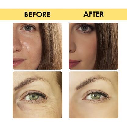 30ml 24K gold hyaluronic acid essence Lift, tighten, reduce redness, restore skin radiance, prevent skin dryness, moisturize