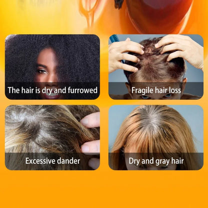 50ML African Hair Growth Oil 100% Pure Batana Hair Growth Mask Butter Anti Hair Loss Break Black Hair Regrowth Treatment