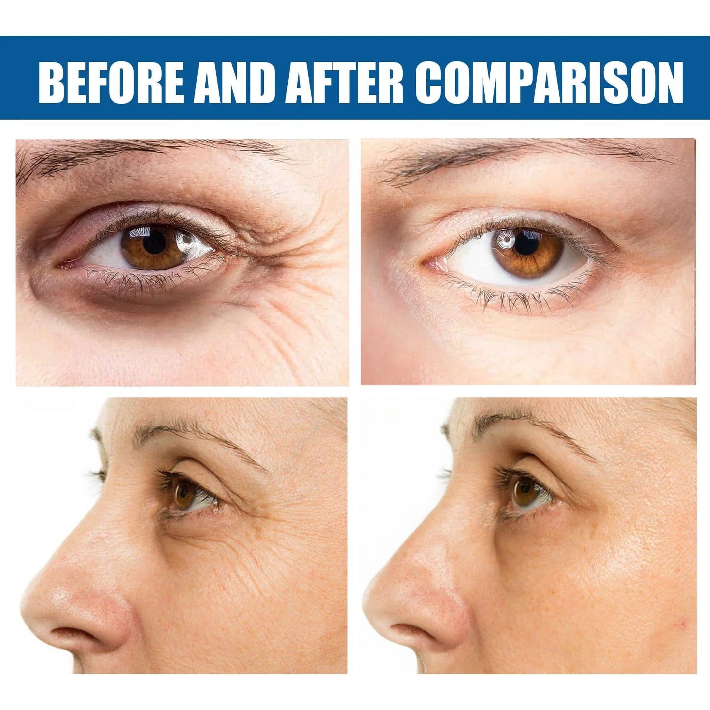 Before and after comparison of using hydrating eye patches for fine lines with visible skin improvement