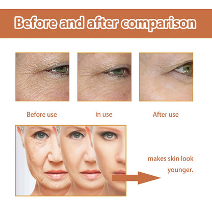 EELHOE removes large pores, shrinks the essence, tightens the face, hyaluronic acid, reduces fine lines, moisturizes and hydrate