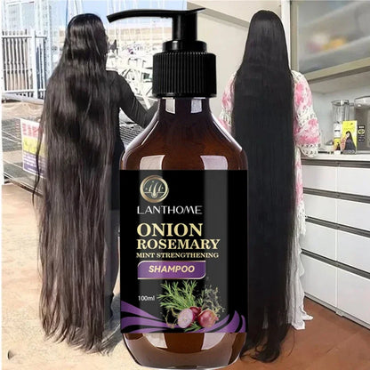 Hair Shampoo For Fast Hair Growth Rosemary Onion Hair Regrowth Shampoo Anti Hair Loss Effective Within 7 Day Hair Care Spray