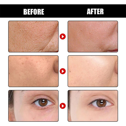 Deep Cleansing Anti-Wrinkle Serum 30ML Vitamin C Anti-aging Firming Skin Fade Fine Lines Easily Absorbed hydrated Tightened