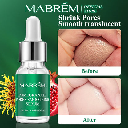 MABREM Pomegranate Fine Pores Face Serum Whitening Plant Skin Care Anti Aging Anti Wrinkle Cream Reduce Acne Marks Care 10ml